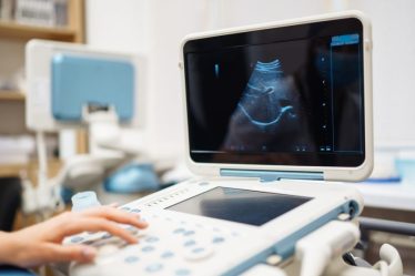 Pentingnya Evolusi Teknologi Ultrasound dalam Bidang Kesehatan