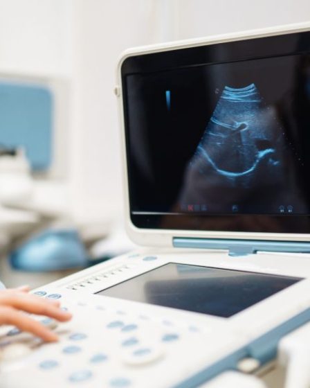 Pentingnya Evolusi Teknologi Ultrasound dalam Bidang Kesehatan