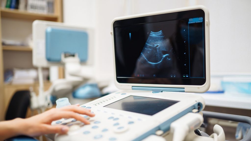 Pentingnya Evolusi Teknologi Ultrasound dalam Bidang Kesehatan