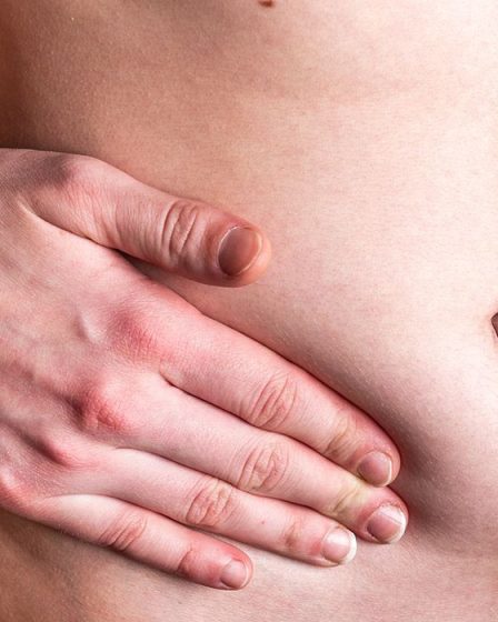 penyakit hernia